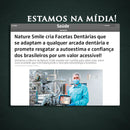 (Nature Smile) - Facetas Dentárias Removíveis Superior e Inferior